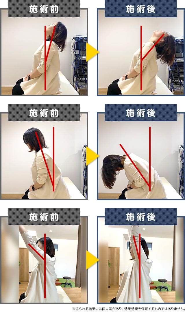 こくあ接骨院で施術したお客様のビフォーアフター