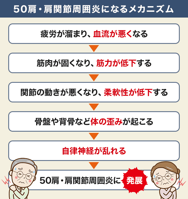 50肩・肩関節周囲炎になるメカニズム